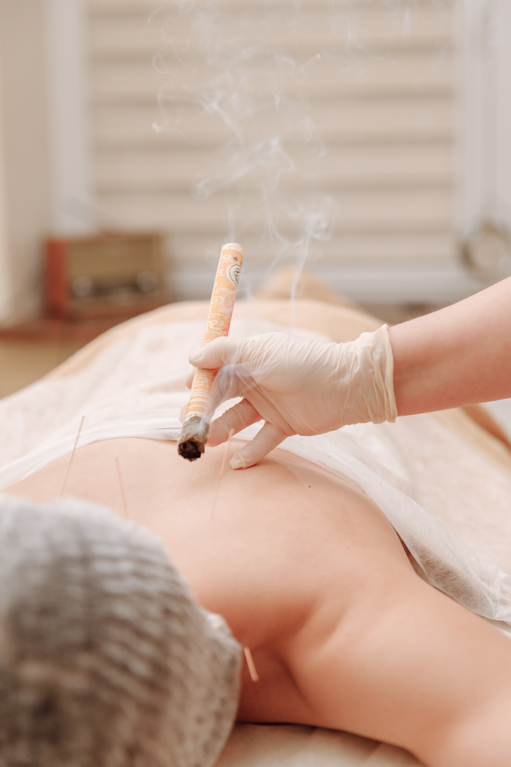 Moxibustion en Médecine Traditionnelle Chinoise MTC